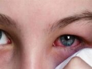 Eye Flu: मानसून में तेजी से बढ़ रहा आई फ्लू का खतरा, जानें इसके लक्षण और इससे बचाव के तरीके cover