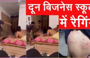देहरादून: बिजनेस स्कूल में जूनियर छात्रों की रैगिंग पर हंगामा तोड़फोड़, रैगिंग की पिटाई से युवक के शरीर पर पड़े नीले निशान, 200 अज्ञात छात्रों पर मुकदमा दर्ज