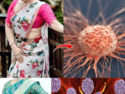 Cancer: साड़ी पहनने वाली महिलाएं इन बातों का रखें ध्यान, आपकी एक गलती बन सकती है कैंसर की वजह 1