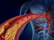 सुबह उठकर करने होंगे बस ये 3 काम, कोलेस्ट्रोल को 30 दिन में कर सकते हैं आराम से कंट्रोल a