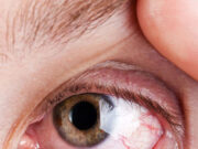 सूख गया है आंखों का पानी तो इन घरेलू नुस्खों से दूर करें दर्द a