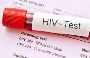 Haldwani News: कुमाऊं में तेजी से बढ़ रहे HIV संक्रमित, हर दिन पांच नए मामले, 15 महीने में 477 नए रोगी