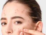 स्किन पर दिखें ये 7 संकेत तो समझें आपका दिल है खतरे में, तुरंत करें जांच 8