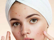 त्वचा पर नजर आते हैं लिवर की खराबी के 5 लक्षण, स्किन प्रॉब्लम समझकर अनदेखा करना पड़ जाएगा भारी 7