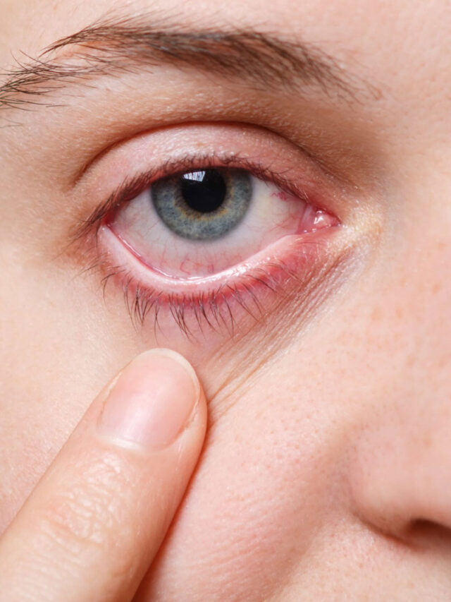 किडनी खराब होने से पहले आंखें देती हैं 6 संकेत, सुबह उठते ही जरूर करें चेक