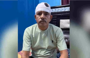 कुत्तों की लड़ाई में मालिकों की हाथापाई: पिटबुल ने किया हमला, लाठियों से किया वार, दरोगा और बेटे का सिर फूटा