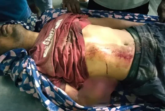 चंपावत के बनबसा में अज्ञात वाहन ने पैदल यात्री को कुचला, 53 वर्षीय व्यक्ति की मौत